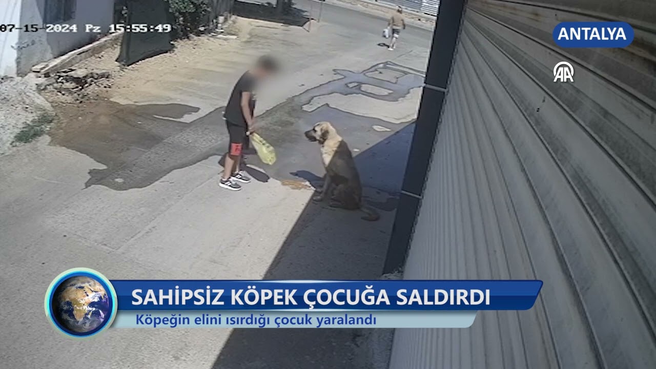 Sahipsiz Köpek Çocuğa Saldırdı -Dim TV Haberler